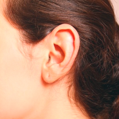 Cirugia de orejas Otoplastia